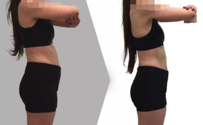 週2回のトレーニングを3ヶ月続けた結果、体脂肪が5％減！